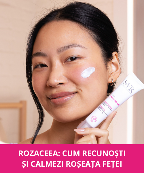 Rozaceea: Cum recunoști și tratezi eficient roșeața feței?
